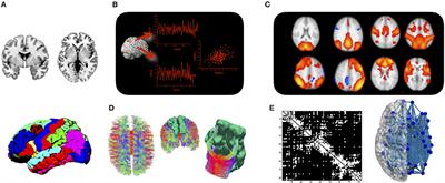 Affective Network Neuroscience